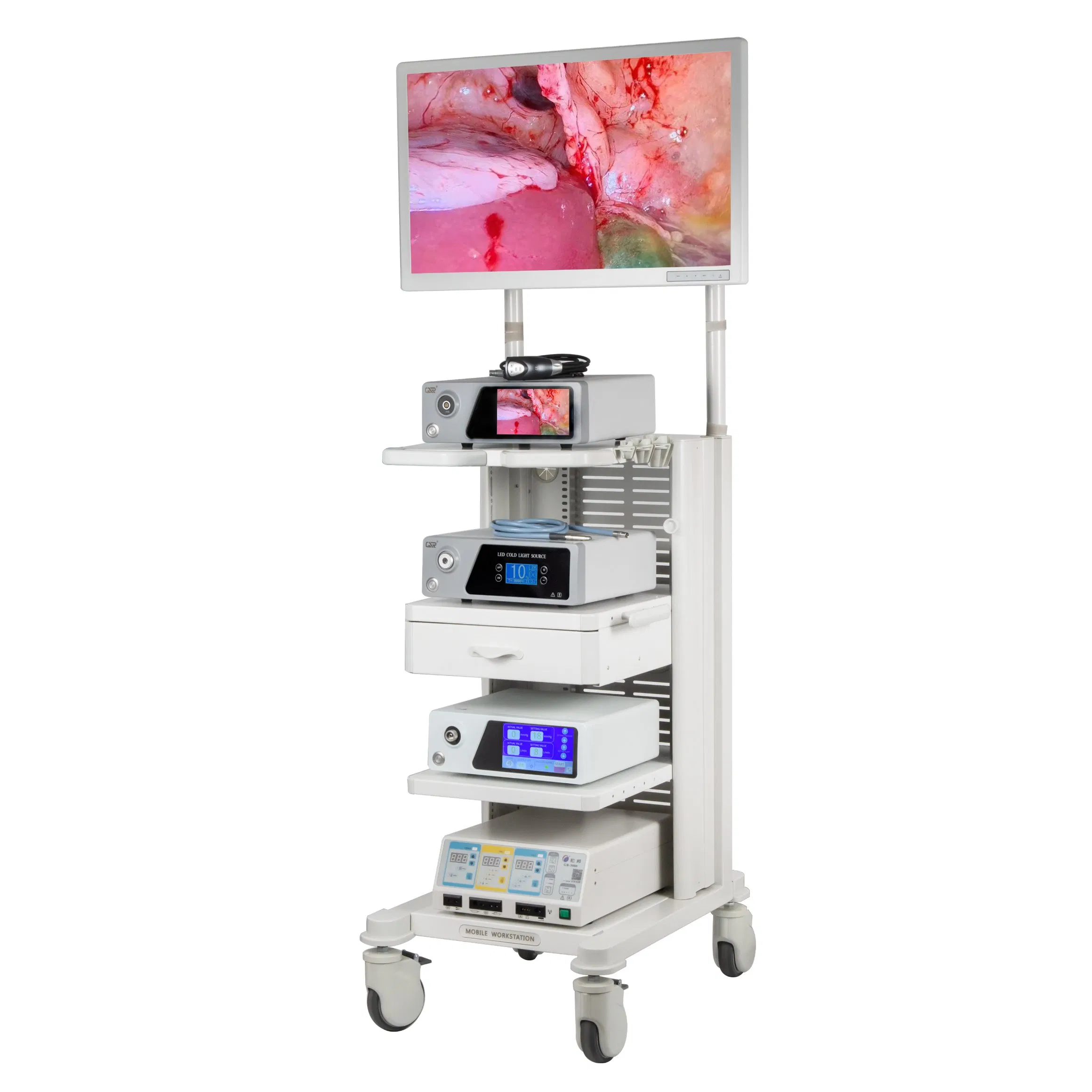 Medical Diagnostic Conchoscope Endoscopic Instrument Endoscopy Equipment 4K Flourescent Endoscope Camera System