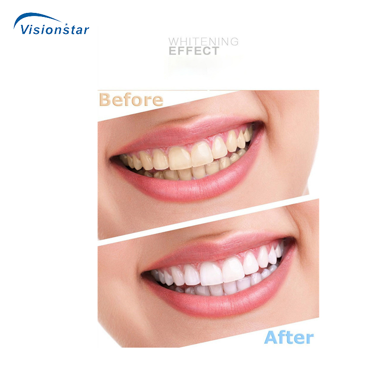 Sjd-E1 Dental Portable Professional Monochromatic Tooth Cold Light Whitening Instrument