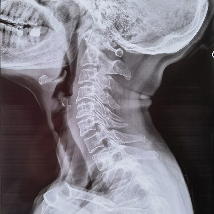 High-Performance Medical Dry Imaging High Density Durable Film Medical Surgical Laboratory Instrument