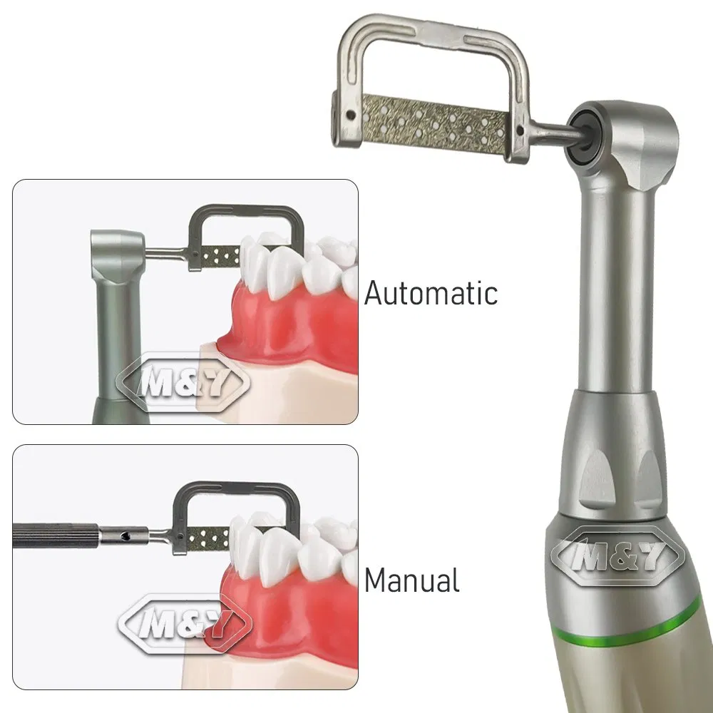 Dental IPR System 2