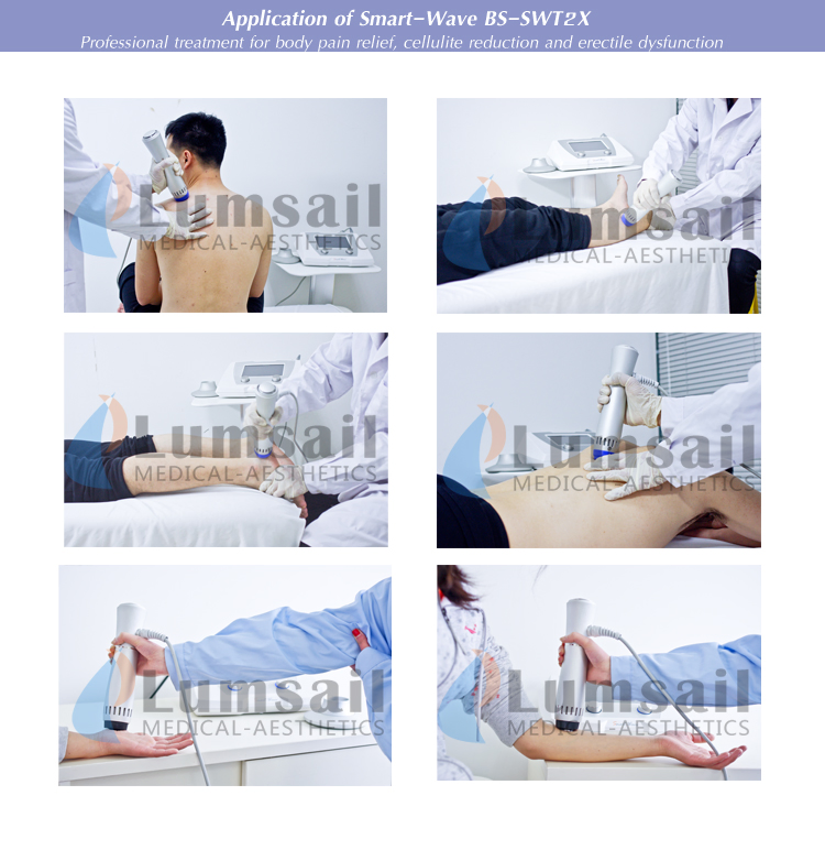 Orthopedic Shockwave Therapy Device for Tendinopathies and Bone Healing