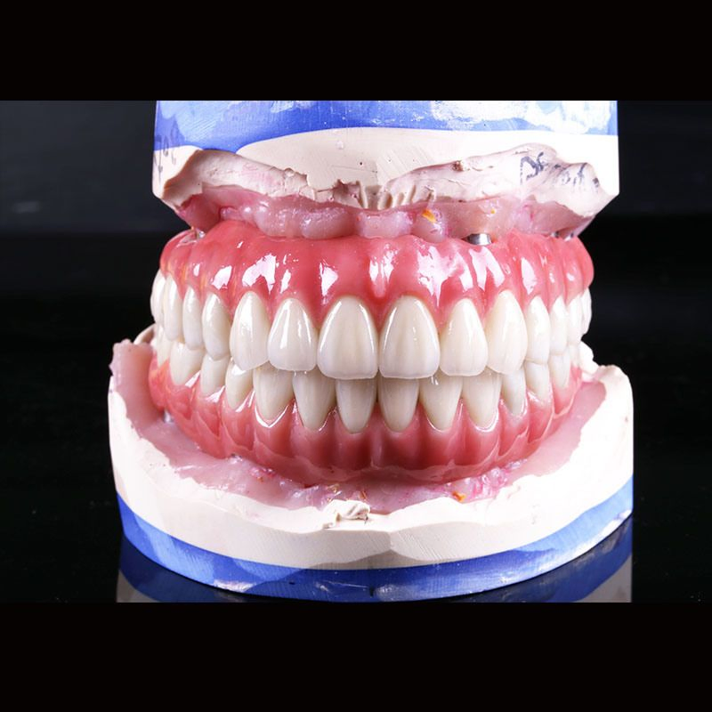 Digital Dental Implant Supplies Ceramic Crown and Bridge Material Instrument