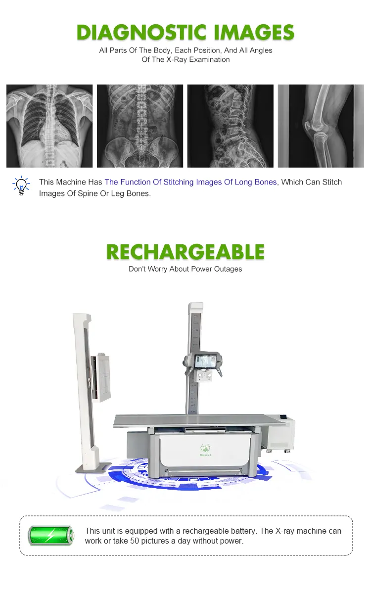 Medical Diagnostic X-ray Machine 2
