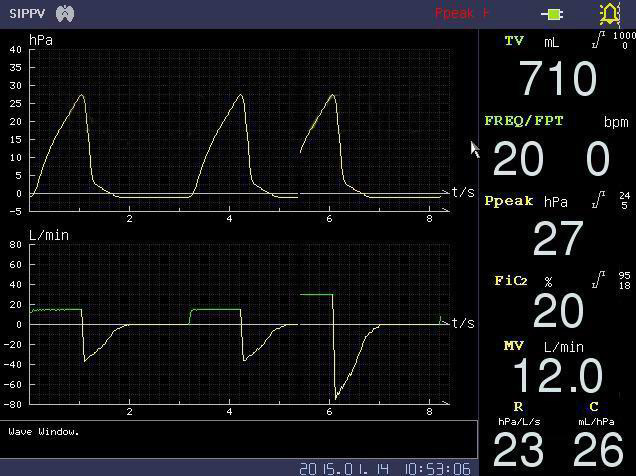 ICU Medical Equipment Supply for Hospitals Respiratory Support Breathing Machine China PA700b