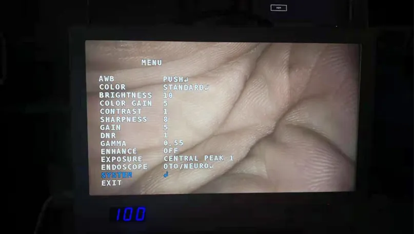 Endoscopy Monitor Display