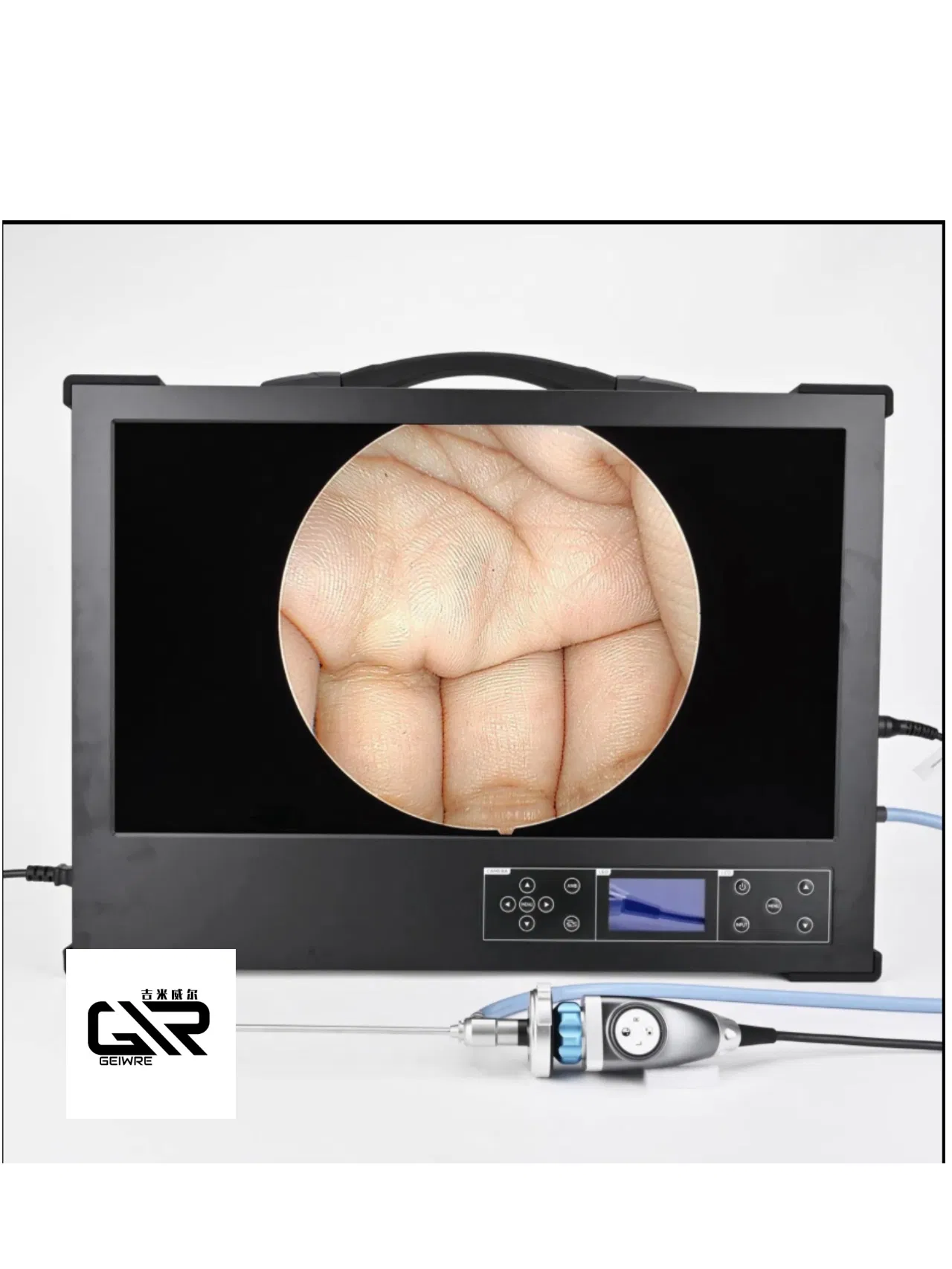 Integrated Endoscope Set - Advanced Medical Imaging Equipment for Hospitals