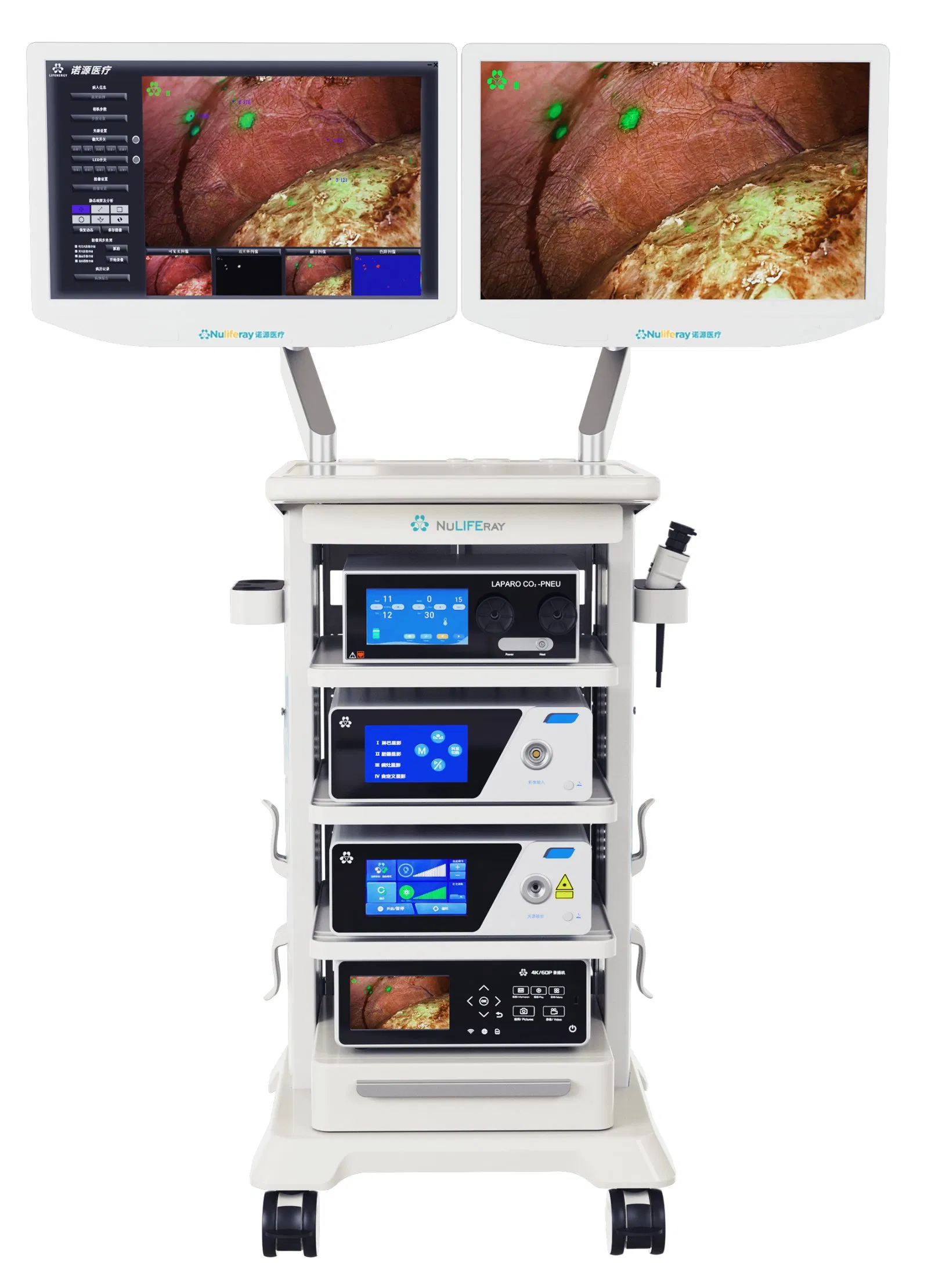 Medical Equipment Medical Apparatus 4K Endoscopy Fluorescence Imaging System Used for Real-Time Imaging Diagnosis During Liver Cancer Surgery