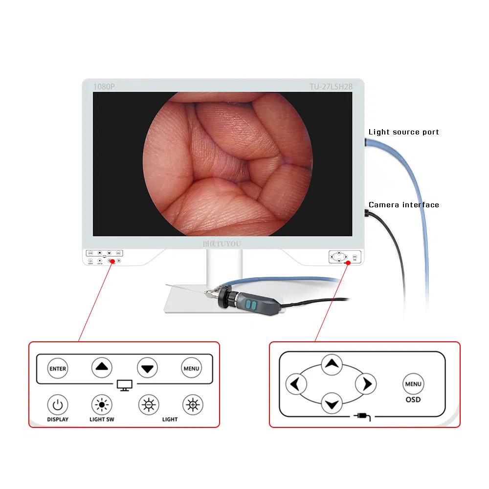 Tuyou High Value HD Medical Endoscopy Equipment with Surgical Endoscope Camera