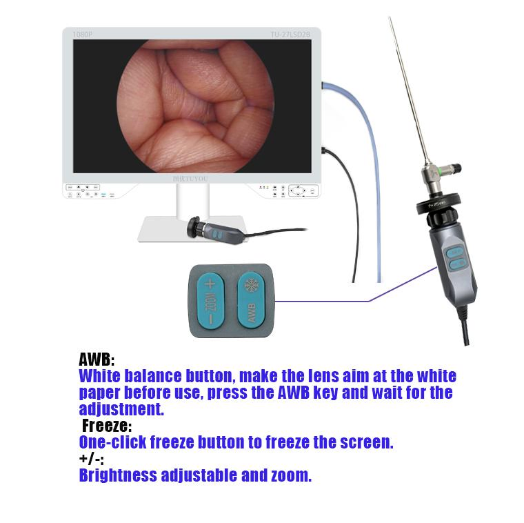 Tuyou High Value HD Medical Endoscopy Equipment with Surgical Endoscope Camera
