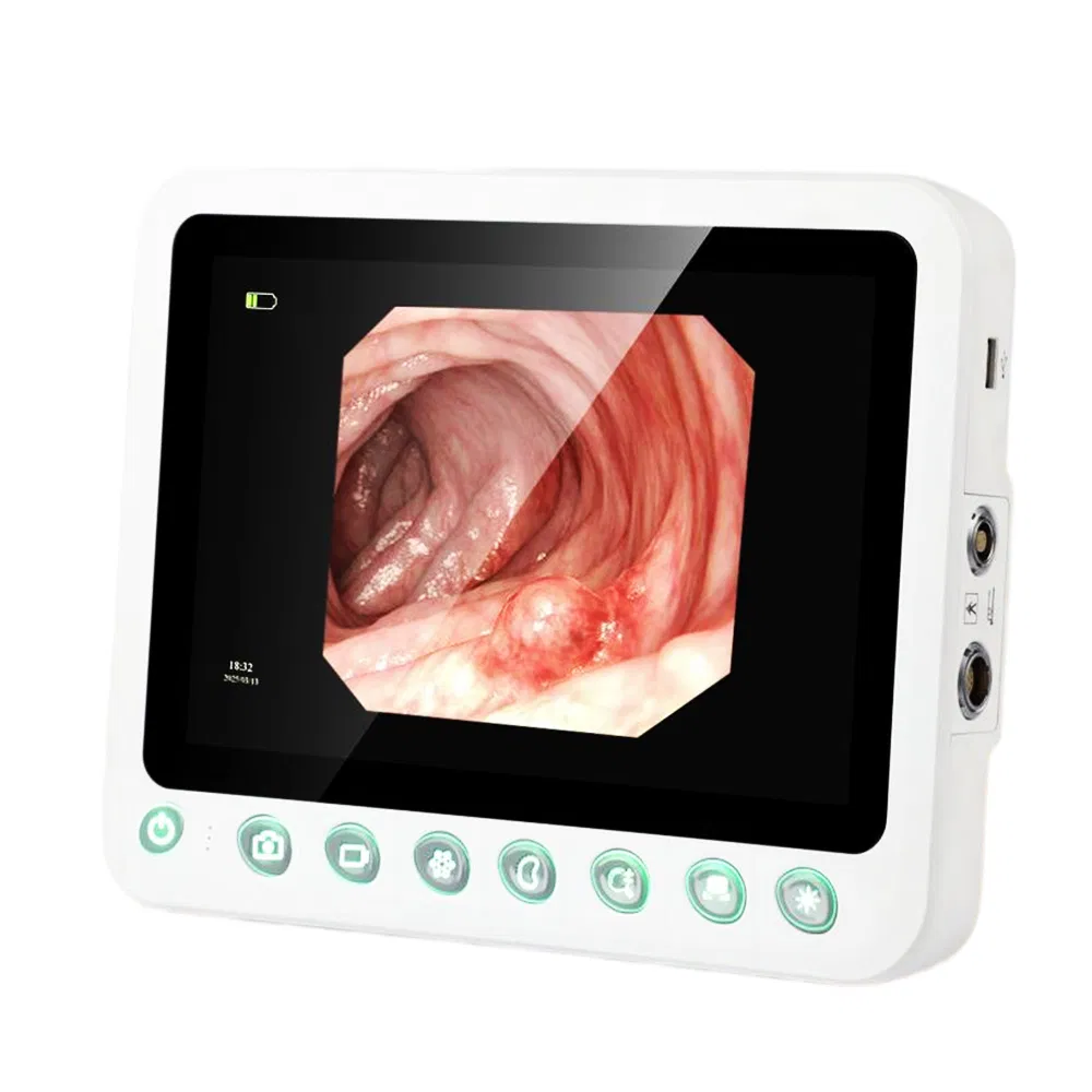 Xbx Durable Endoscopy Supplier Ent Hospital Diagnosis Machine Manufacturers Flexible High-Resolution Medical Endoscope Equipment