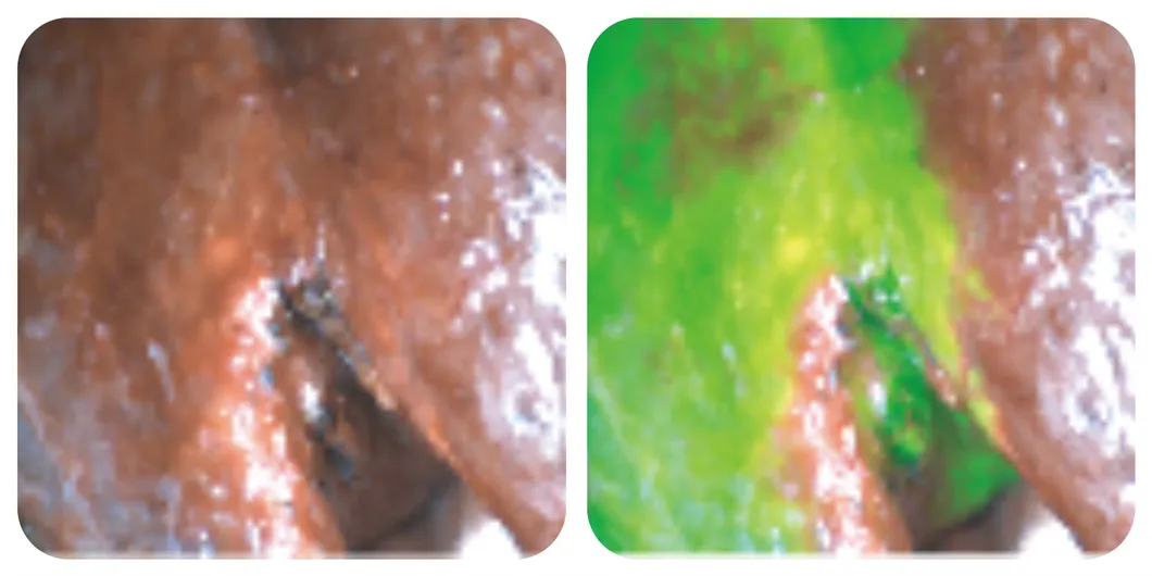 Liver segment staining