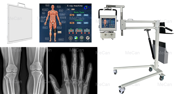 China Imaging Diagnostic Xray Medical Equipment