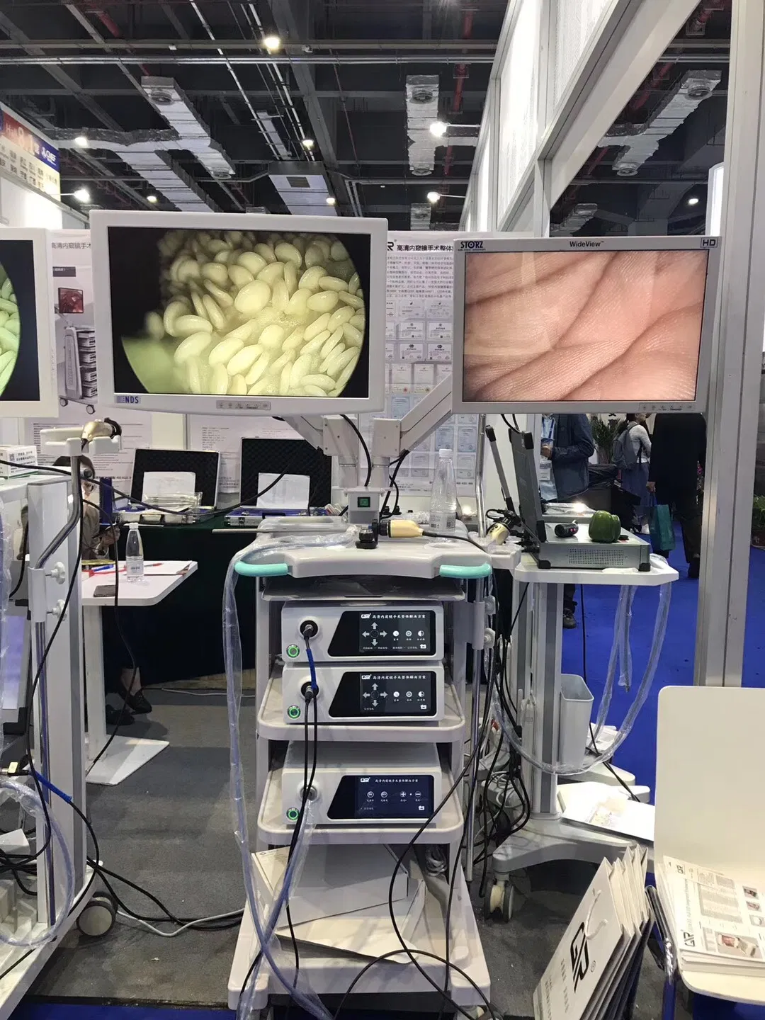 Medical Surgical Equipment Ent Endoscopy with Full HD