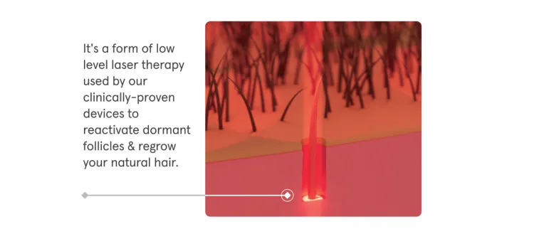 Hair Growth Therapy 1