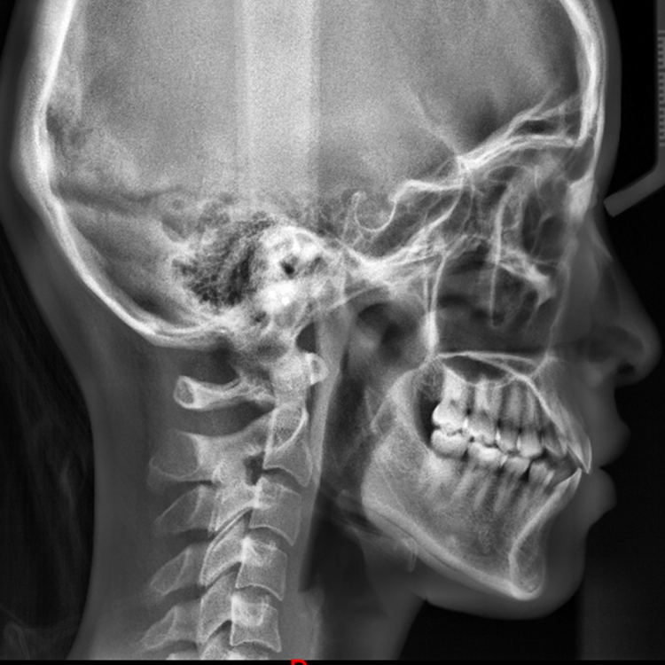 Smart3d Dental Hospital Medical Equipment High Frquency Digital Panoramic Imaging Cbct