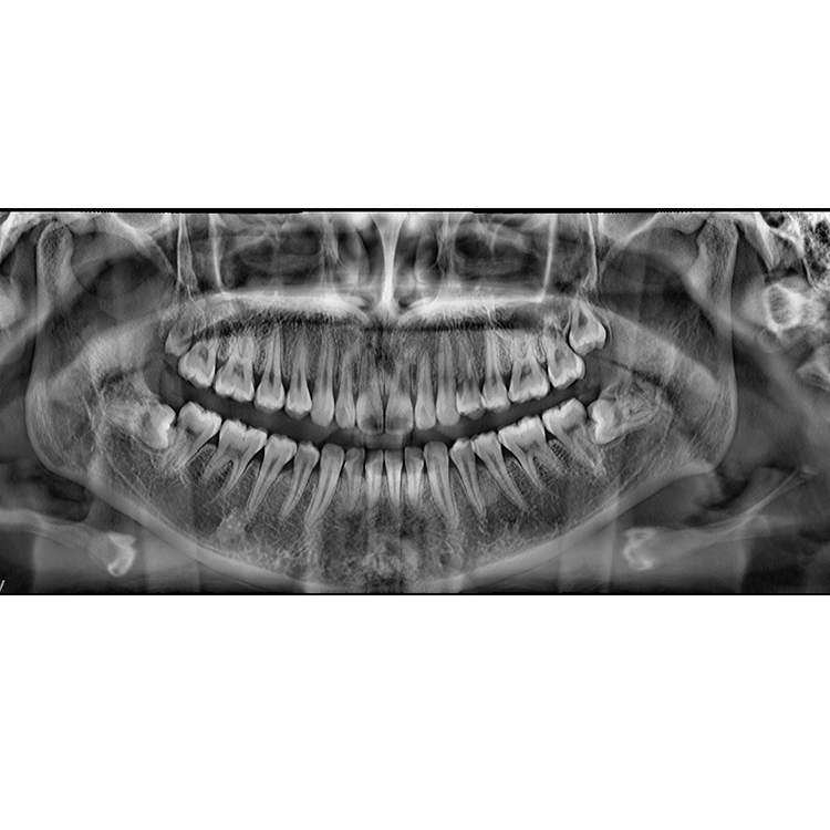 Smart3d Dental Hospital Medical Equipment High Frquency Digital Panoramic Imaging Cbct