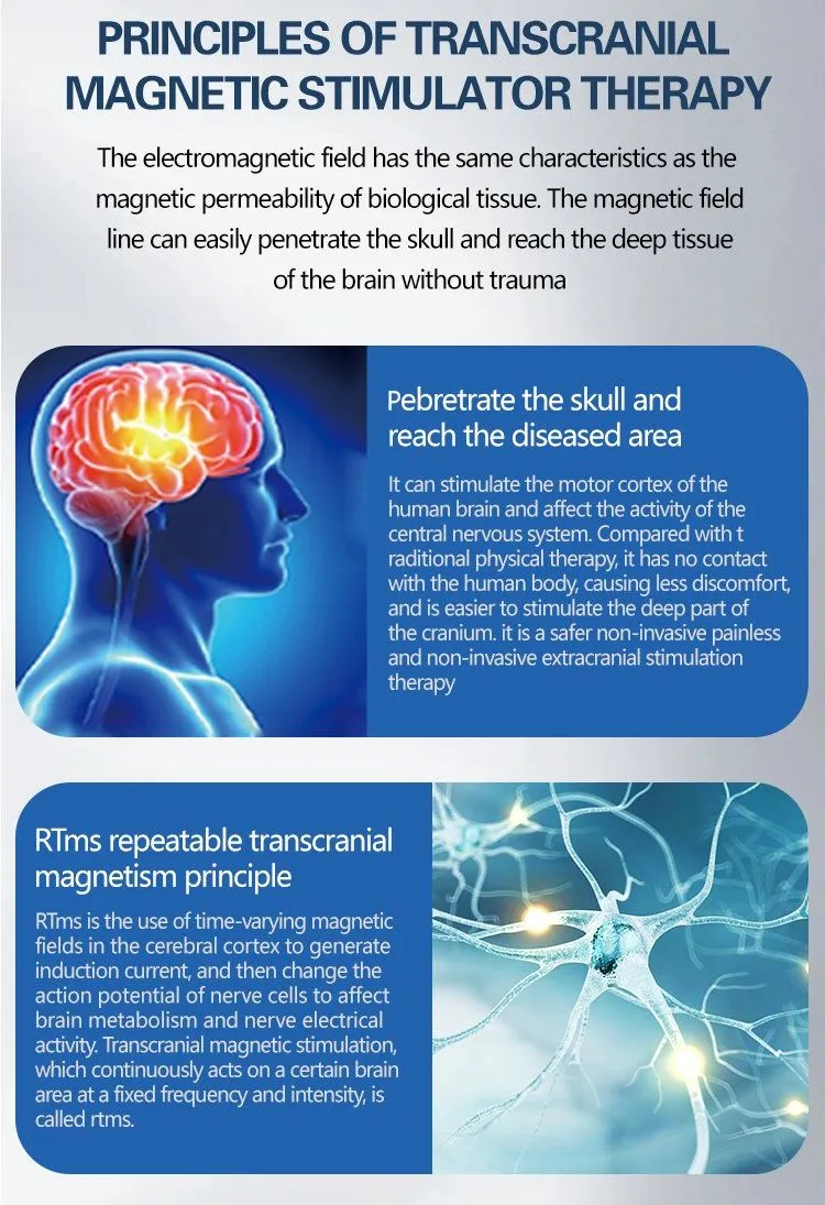 TMS Technical Detail