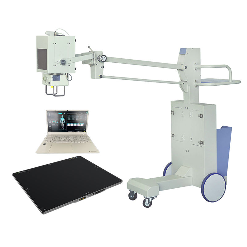 Smart Digital X Ray Machines Medical Diagnosis Equipment for Enhanced Imaging