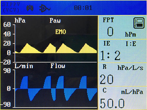 Factory Supply Medical Equipment Anesthesia System of ICU &amp; Emergency Hospital Ventilator