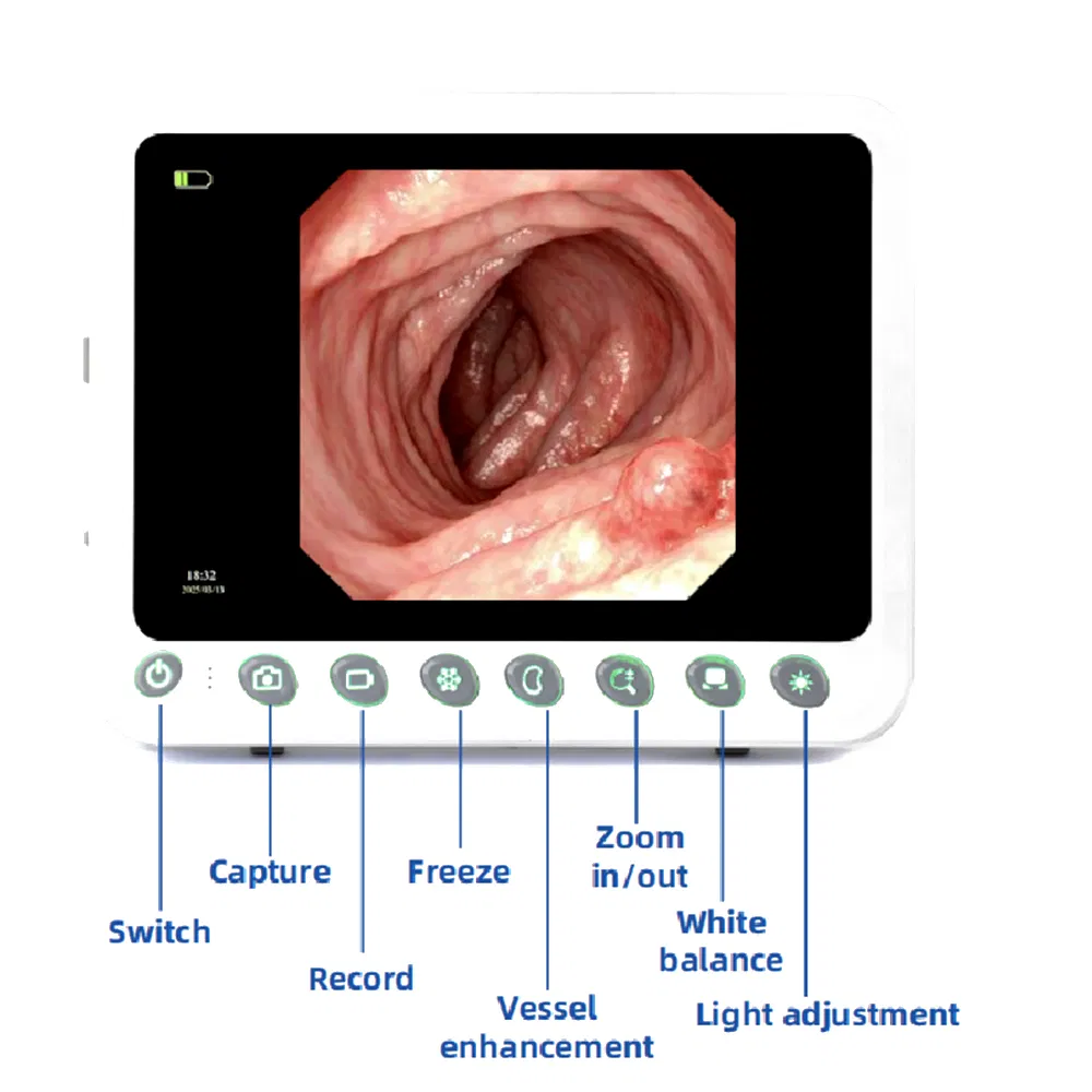 Xbx Durable Endoscopy Supplier Ent Hospital Diagnosis Machine Manufacturers Flexible High-Resolution Medical Endoscope Equipment