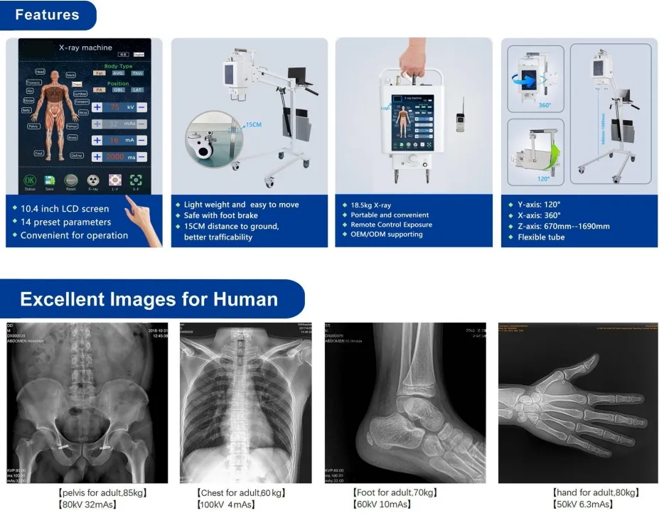 X-ray system details