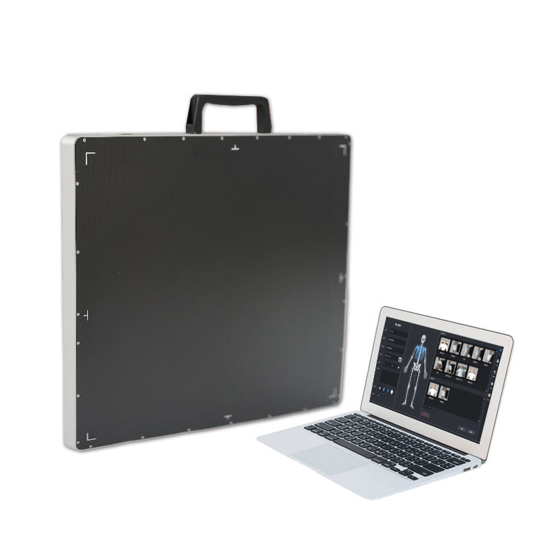 Compact Reliable X Ray Equipment, Medical Diagnosis Equipment for Emergency Rooms