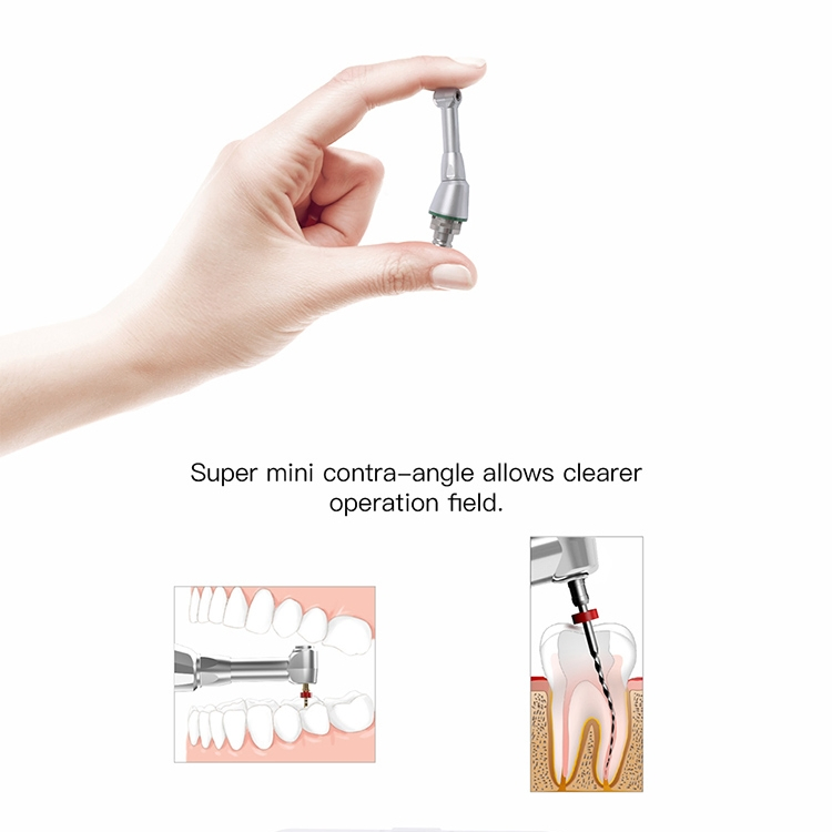Dental Rotary Niti Files Root Canal Instrument for Root Canal Treatment