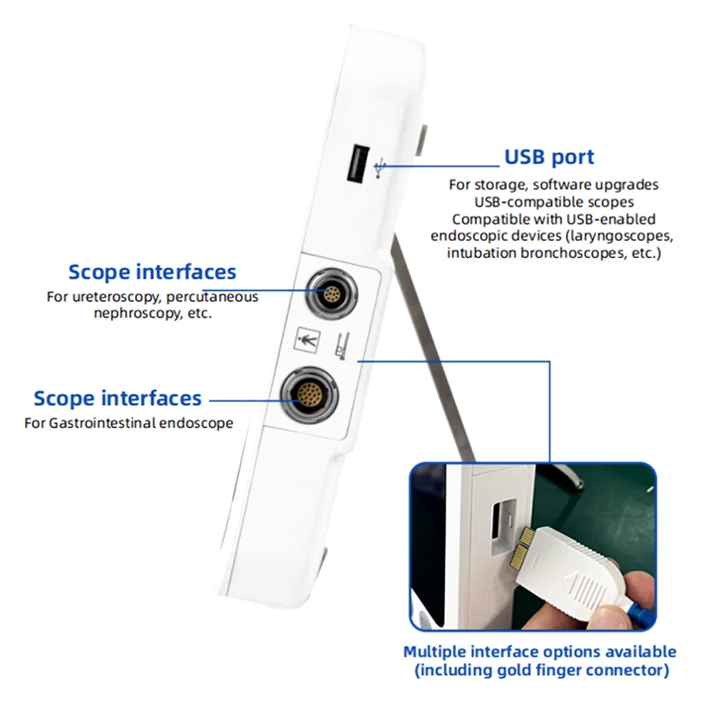 Xbx Durable Endoscopy Supplier Ent Hospital Diagnosis Machine Manufacturers Flexible High-Resolution Medical Endoscope Equipment