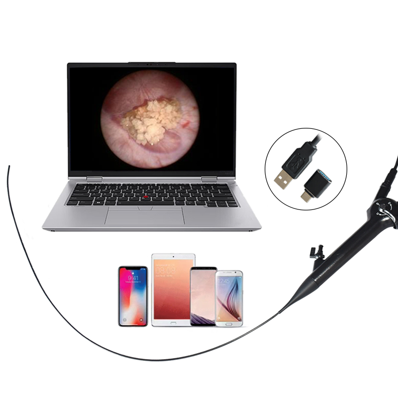 High Definition Integrated Endoscopy Camera Flexible Rigid Medical Imaging Equipment