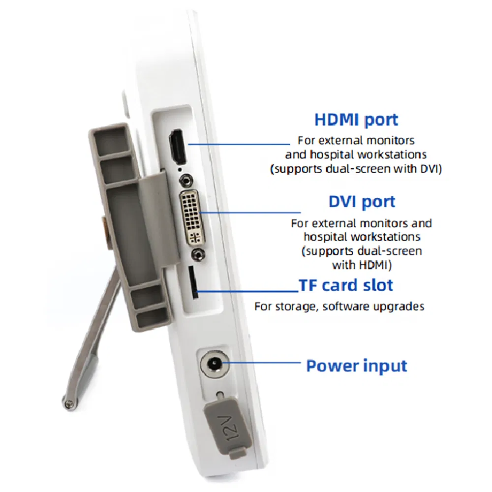 Xbx Durable Endoscopy Supplier Ent Hospital Diagnosis Machine Manufacturers Flexible High-Resolution Medical Endoscope Equipment