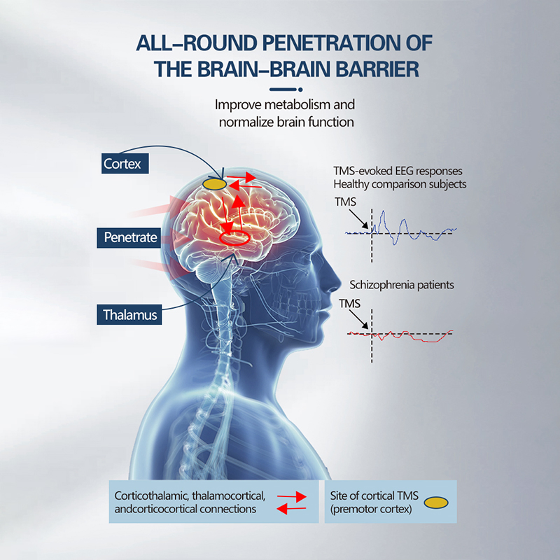 High Precision Tms Therapeutic Apparatus - CE Certified Neurostimulation Device for Depression, Parkinson's &amp; Alzheimer's