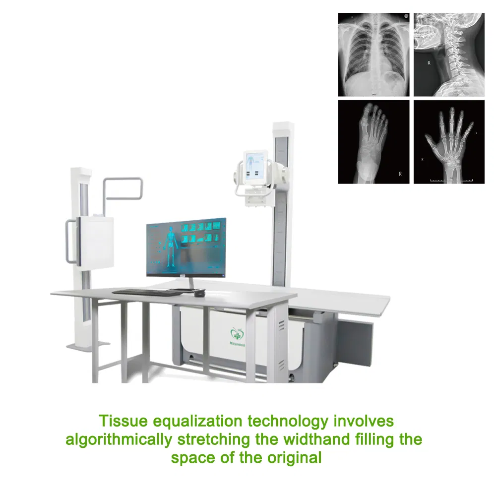 My-D023G High Frequency Medical X-ray Diagnostic Hf X-ray Machine Medical Xray Equipment for Clinic