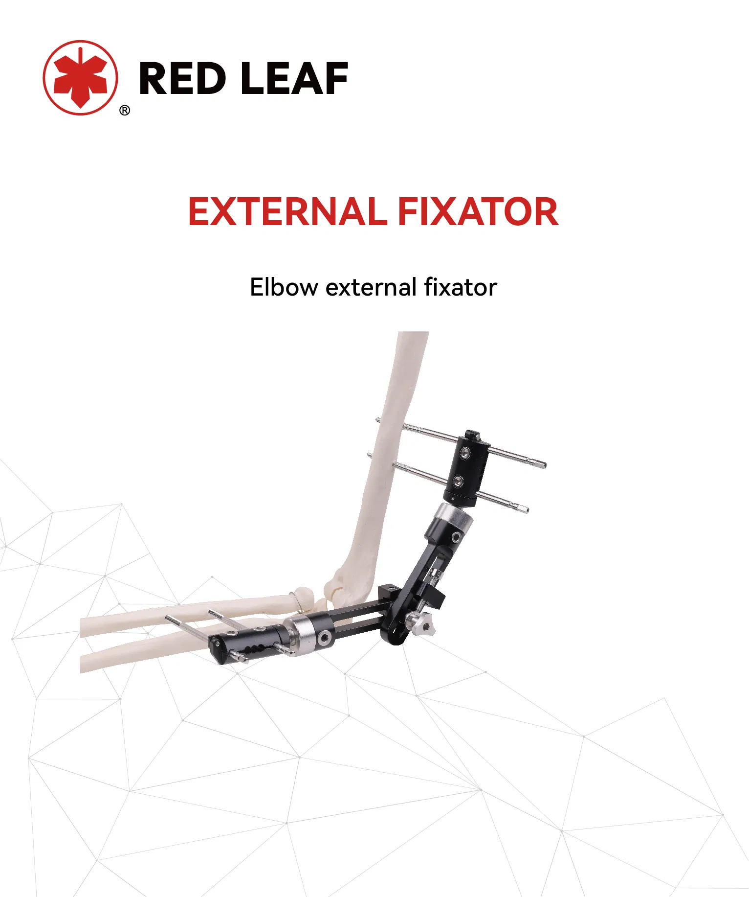 Medical-Grade Elbow Joint Fracture Surgery External Fixator Orthopedic Extremities Fixation