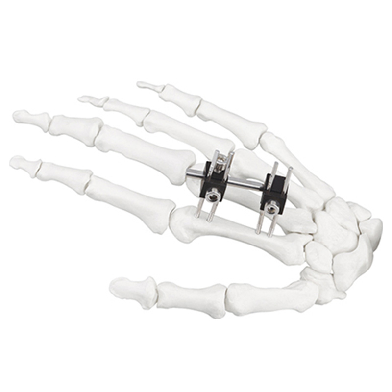 Orthopedic Surgical Instruments Mini External Fixator Joint Motion Type