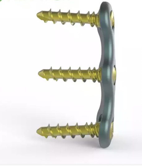 Anterior Cervical Fixation System with Screw for Cervical Spine with CE Certificate