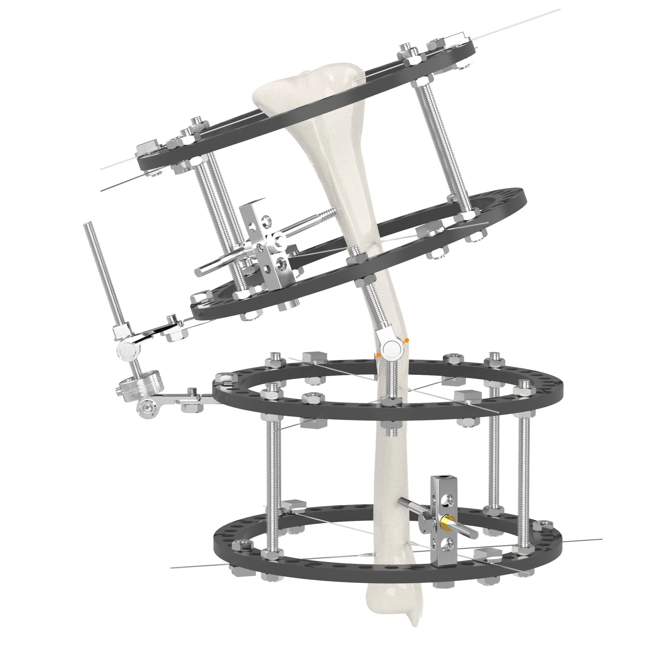 OEM CE Ilizarov External Fixators Prices Skeletal Set Lengthening Tibial Pelvis Clamp Frame
