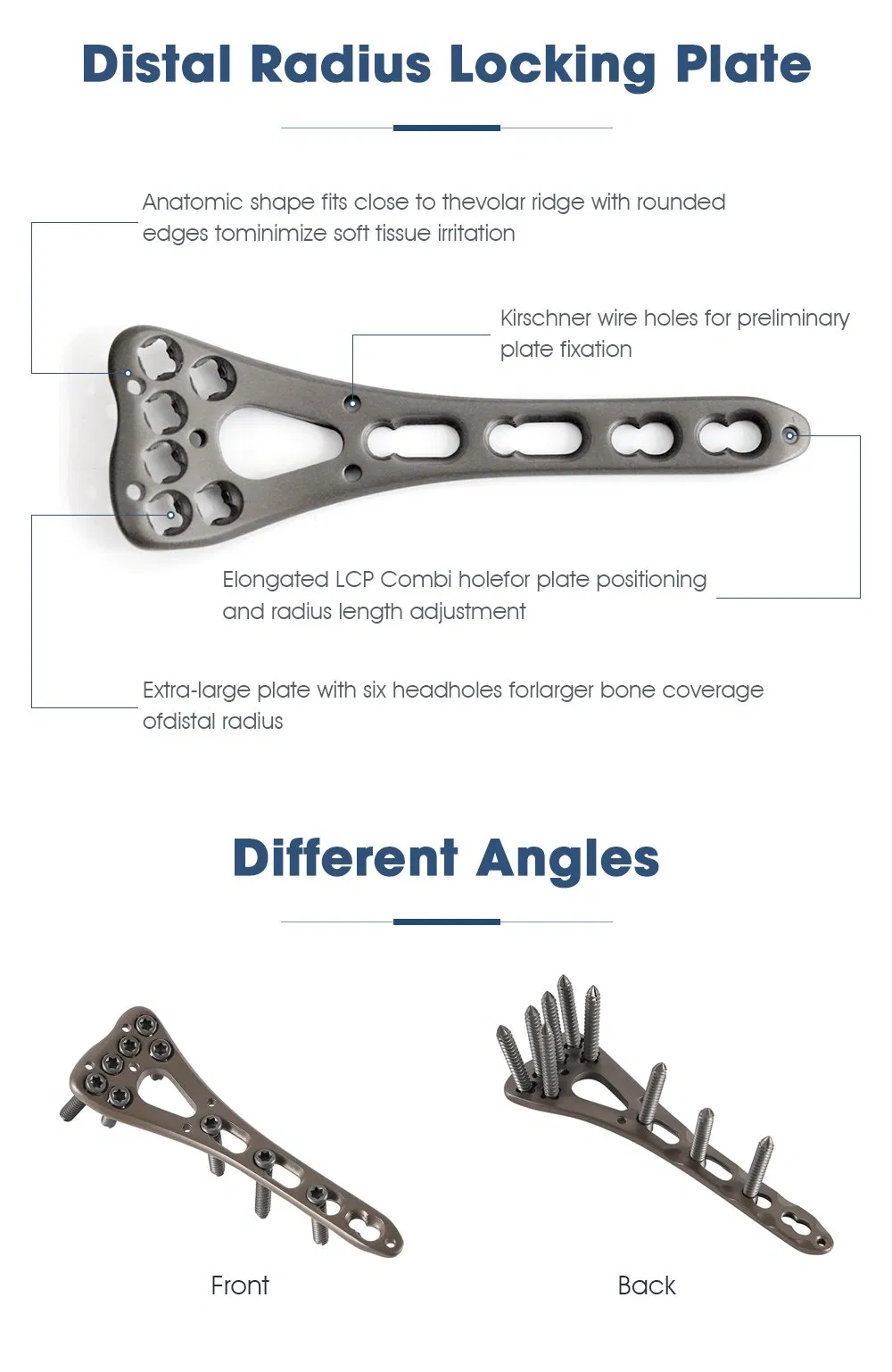 Ortho Implant View 2