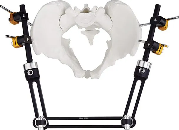 Pelvic External Fixator Details