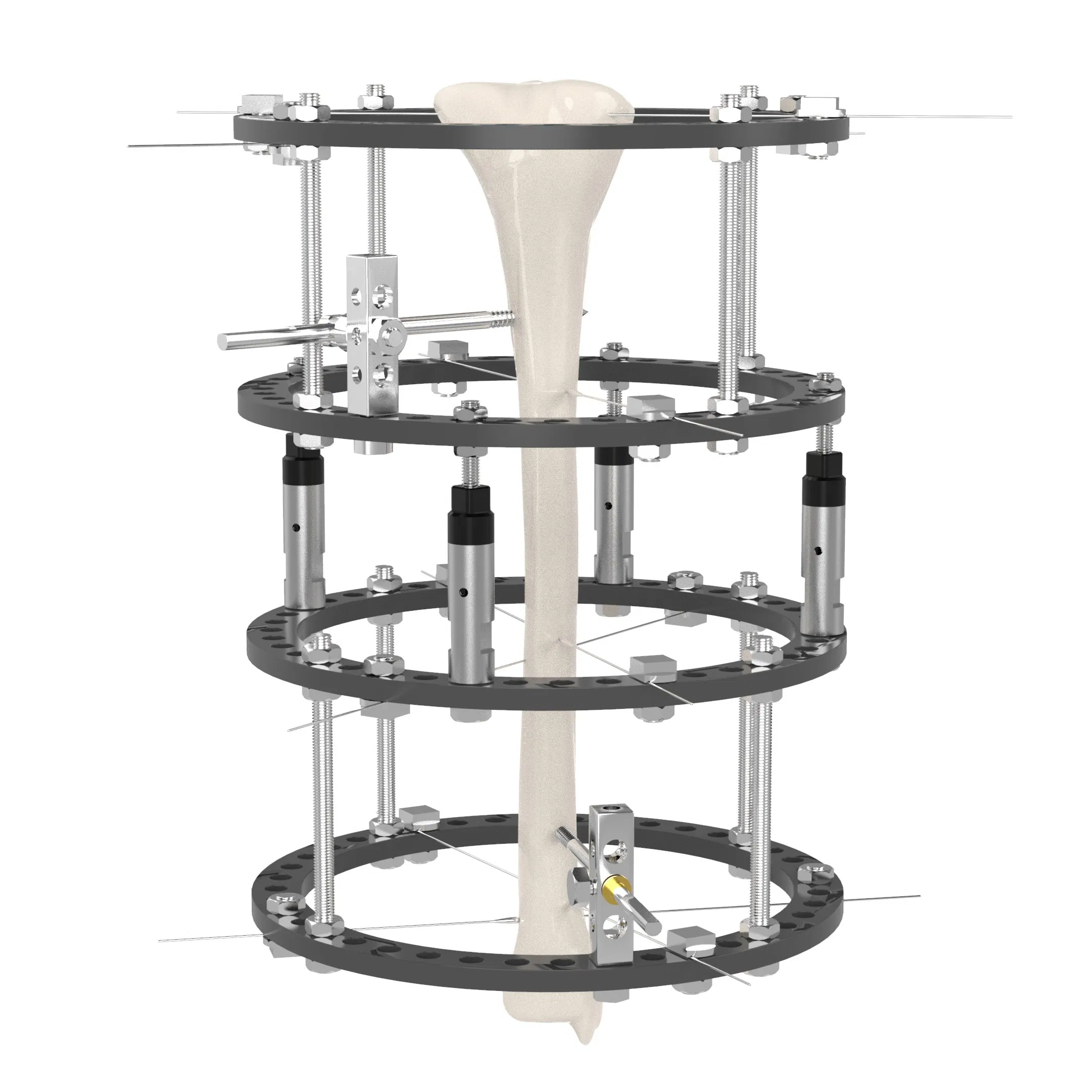 OEM CE Ilizarov External Fixators Prices Skeletal Set Lengthening Tibial Pelvis Clamp Frame