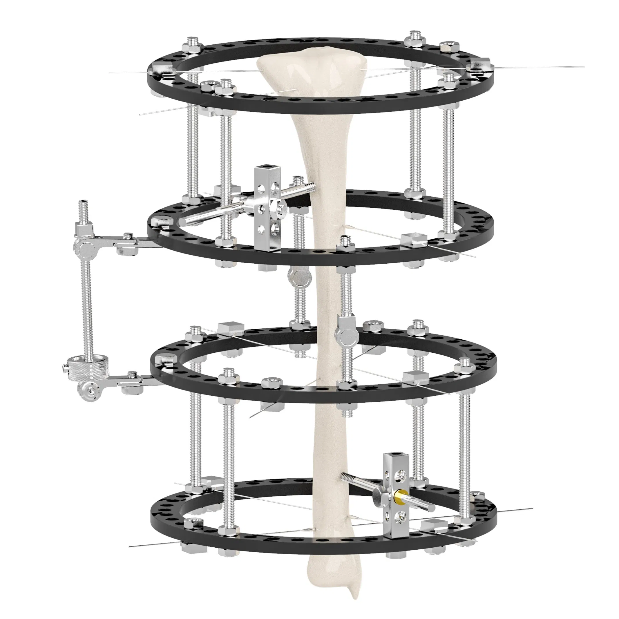 OEM CE Ilizarov External Fixators Prices Skeletal Set Lengthening Tibial Pelvis Clamp Frame