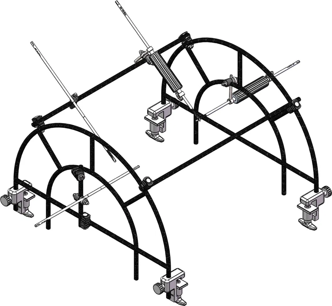 Pelvic External Fixator 1