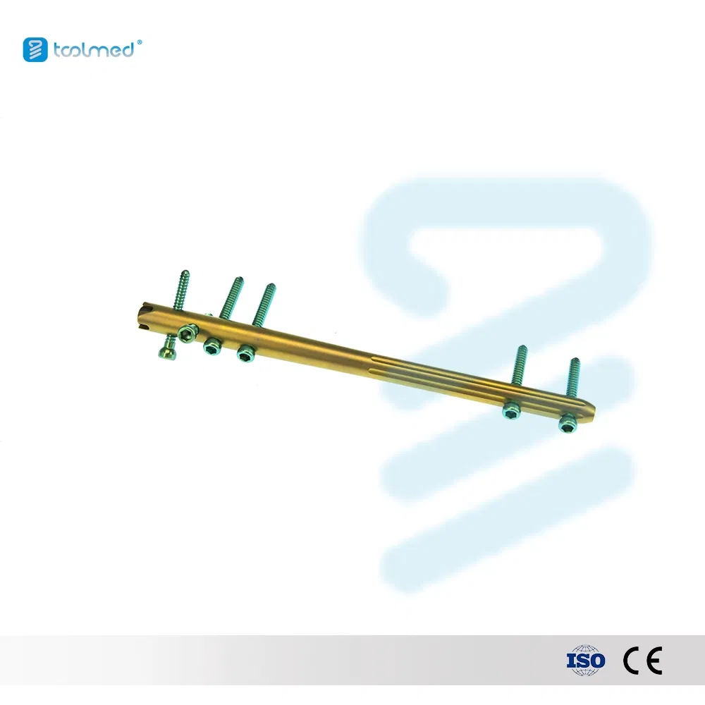 Orthopedic Trauma Interlocking Intramedullary Nail for Femur 9.5*340