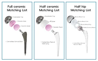 Total Hip and Knee Joint Replacement Metal Titanium Implant