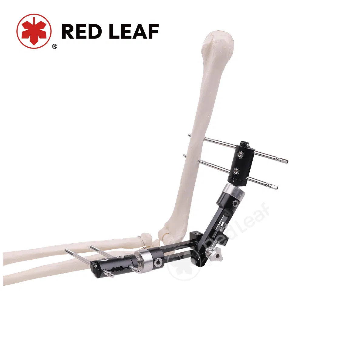 Medical-Grade Elbow Joint Fracture Surgery External Fixator Orthopedic Extremities Fixation