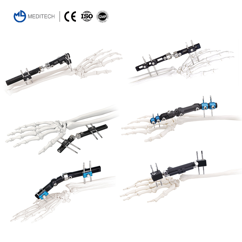 Small Fragment Stainless Steel Orthopedic Clamp Ulna &amp; Radius External Fixator for Bone Surgery Instruments