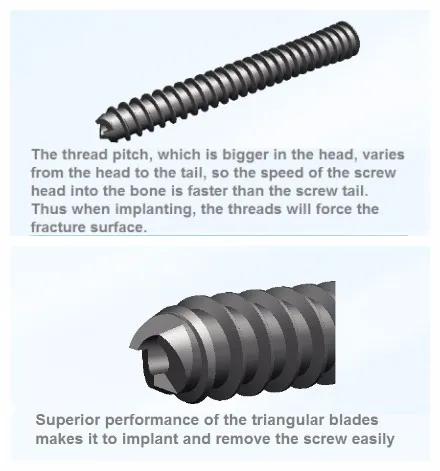 Compression Screw Detail 1