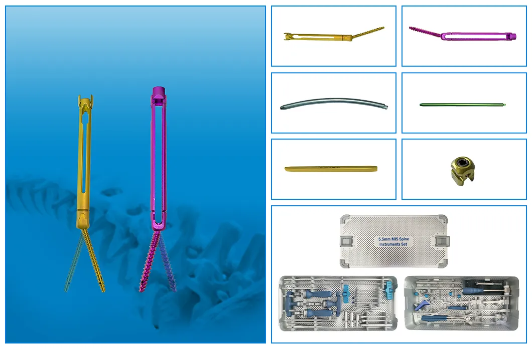 SF-IV MIS System Overview