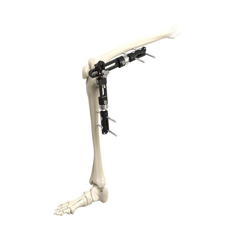 Surgical Instruments Orthopedic Fixationpelvic External Fixator-Combination Three