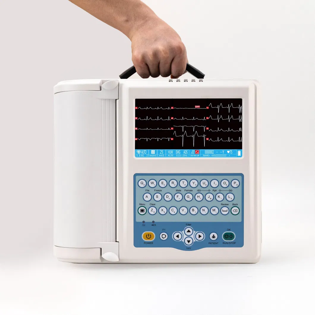 Detalle ECG 2