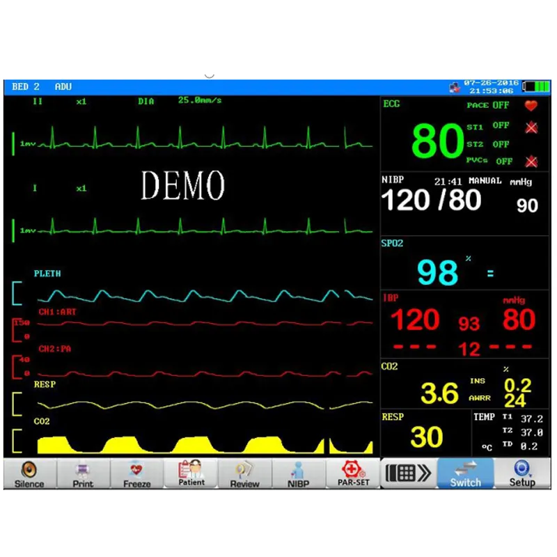 SpO2 Parameter
